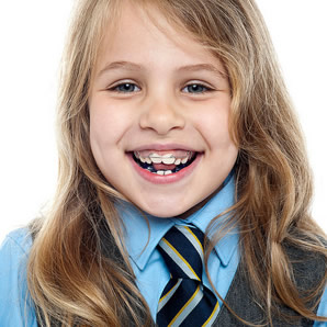 orthodontic retention